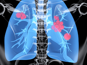 现代人体 肺部 人体器官 人体组织3d模型