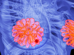 人体乳腺病变场景 人体组织 人体器官3d模型