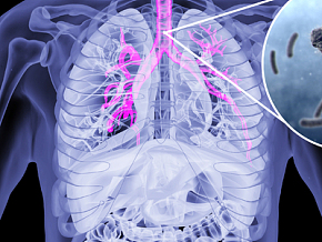 人体支气管炎 人体器官 人体组织3d模型