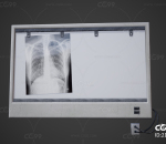 次世代 X射线胶片观察灯 X光设备 医院设备 观片灯 阅片灯 看片灯 LED观片灯
