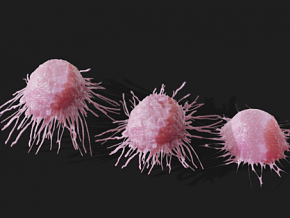 癌细胞 肿瘤 细胞 肿瘤细胞 病毒 癌症 生物医学 细胞核 SCI 医学解剖 人体癌细胞 癌症细胞扩